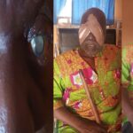 76 year old blind man regains sight after an Igbo group paid for his eye surgery