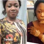 Lagos landlord and his wife disfigure tenant's face over ‘quit notice’