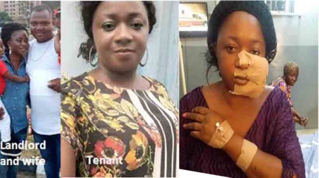 Lagos landlord and his wife disfigure tenant's face over ‘quit notice’