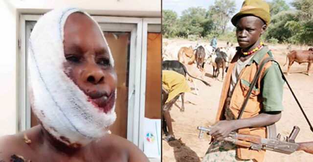 Suspected Fulani herdsmen shoot woman in the head in Ogun (Video)