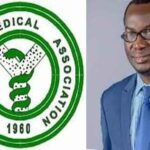 One doctor attends to 4000 Nigerians — ex-NMA President