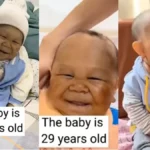 Meet 29-year-old ‘baby’ who can’t grow due to rare medical condition