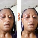 India-based Nigerian lady reportedly a$saulted by her traff#cker who thre@tened to make her blind over N1m