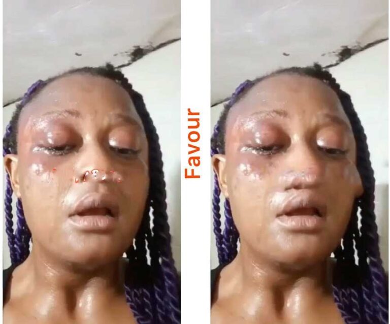 India-based Nigerian lady reportedly a$saulted by her traff#cker who thre@tened to make her blind over N1m