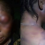 Woman allegedly battered by her husband over disagreement with his girlfriend in Rivers