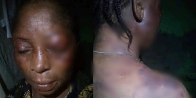 Woman allegedly battered by her husband over disagreement with his girlfriend in Rivers