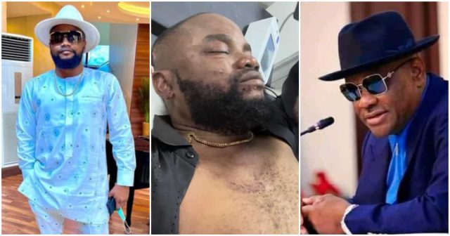 Lead singer of Governor Wike's band survives motor accident
