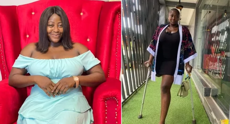 Men date me out of pity – Amputee actress, Doris Akonanya