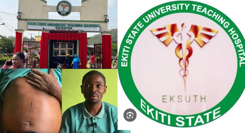 Ekiti University Teaching Hospital Dismisses Surgeon for Unauthorized Kidney Removal