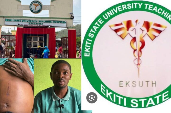 Ekiti University Teaching Hospital Dismisses Surgeon for Unauthorized Kidney Removal