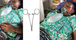 44-Year-Old Woman D+es After Surgical Tool Was Allegedly Forgotten in Her Body After Fibroid Surgery